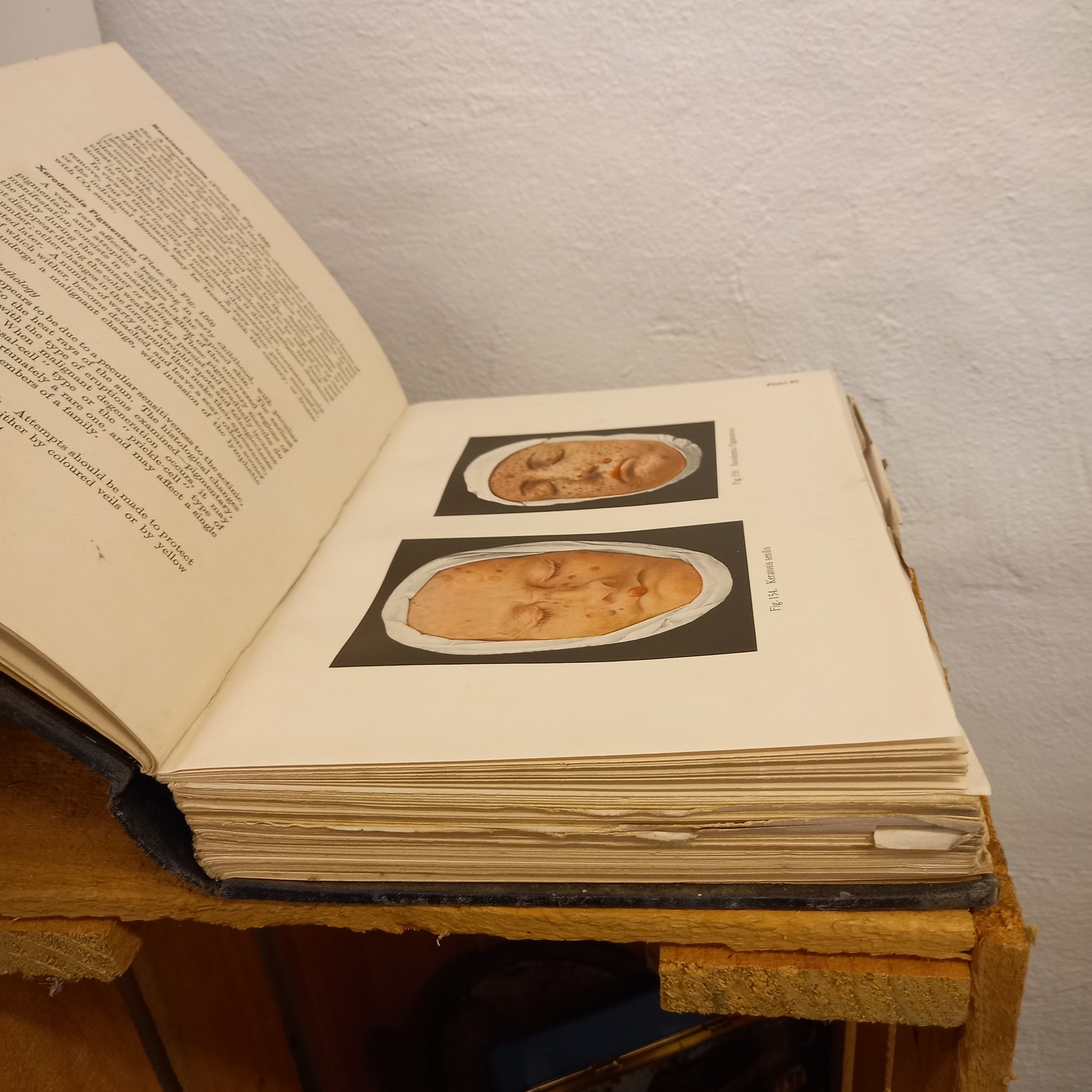 Jacobi's Atlas of Dermochromes, Volumes I & II by Henry MacCormac (1926)-Book - Vintage Medical Book Set-Tilbrook and Co